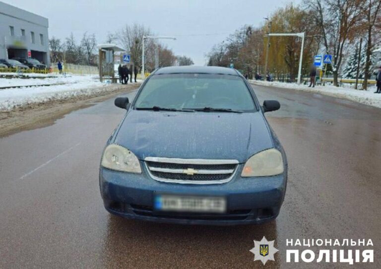У Коростені водій Chevrolet на пішохідному переході збив 8-річного хлопчика, дитина в реанімації