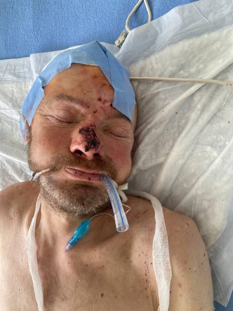 УВАГА! Поліція просить допомогти опізнати людину