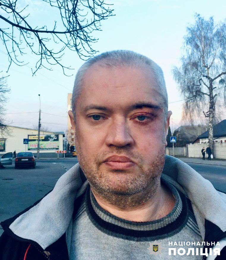 Поліція розшукує безвісно зниклого 48-річного житомирянина!