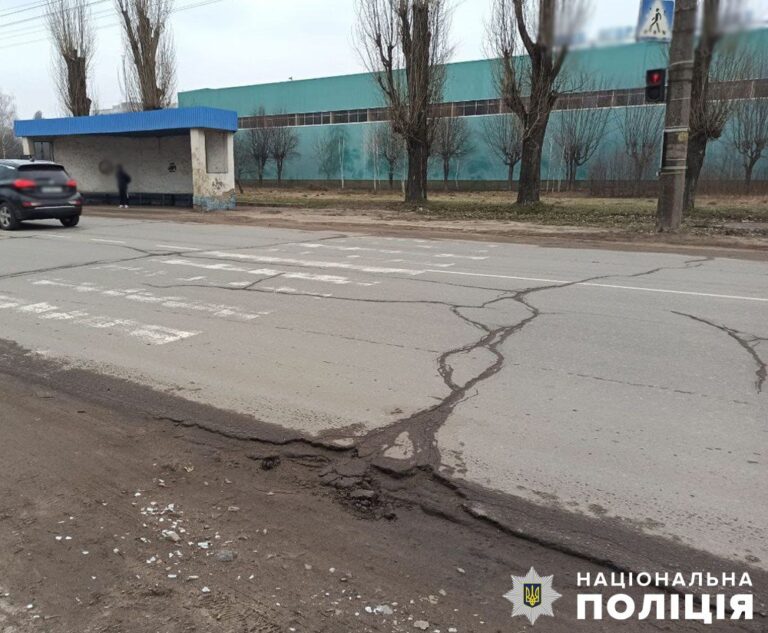 Поліцейські встановлюють обставини ДТП з травмуванням дитини у Житомирі