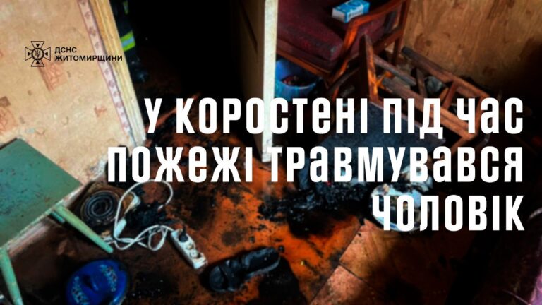 У неділю під час пожежі у квартирі коростенської поверхівки травмувався чоловік