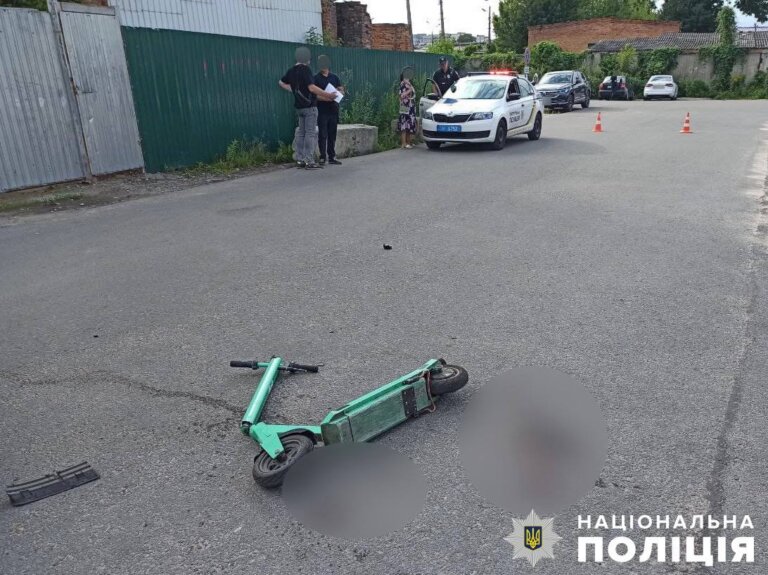 У Житомирі в ДТП травмовано неповнолітнього керманича самоката: поліцейські з’ясовують обставини