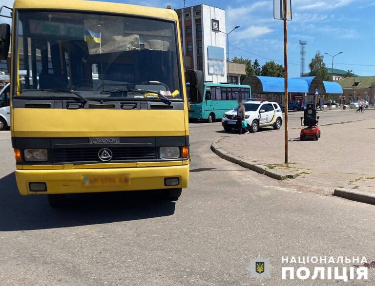 У Коростені поліція розслідує ДТП з травмуванням жінки