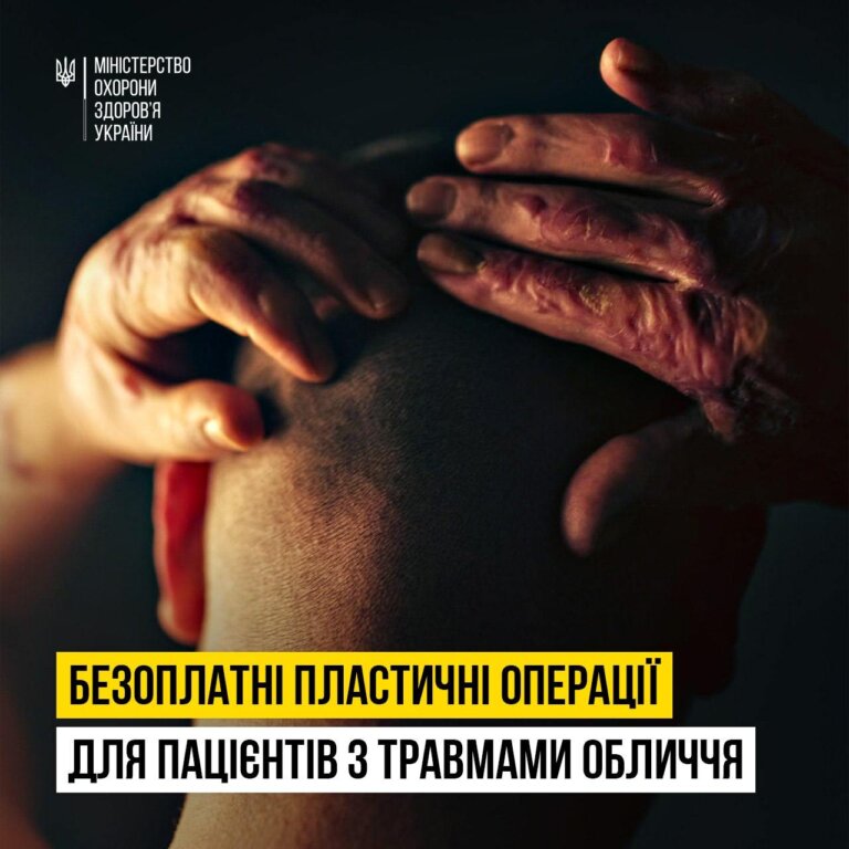 Розпочинається набір пацієнтів з травмами обличчя для участі в четвертій місії FACE TO FACE 2024!