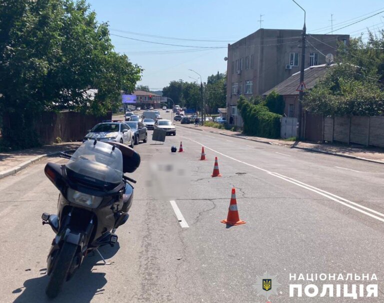 У Житомирі в ДТП травмовано 76-річного пішохода: поліцейські розпочали розслідування