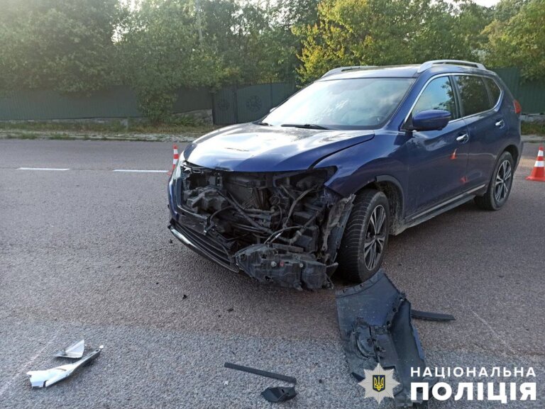 У Тетерівській громаді в ДТП травмовано 15-річного мопедиста: поліція розпочала розслідування