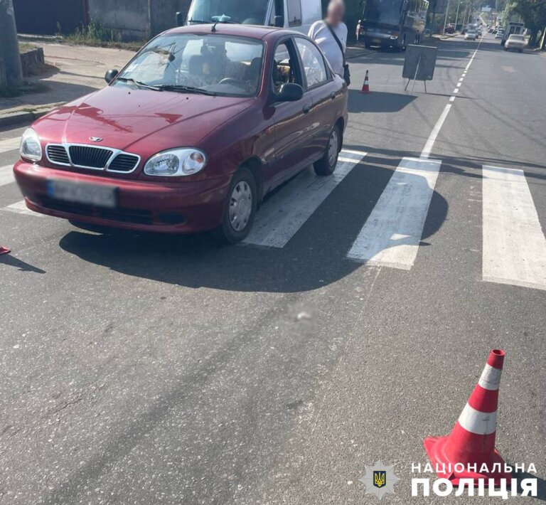 У Бердичеві поліція з’ясовує обставини ДТП з травмуванням пішохода