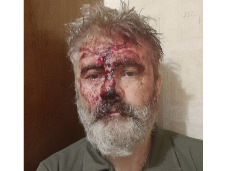 Невідомі побили митрополита Кримського та Симферопольського Климента, який також є військовим ЗСУ