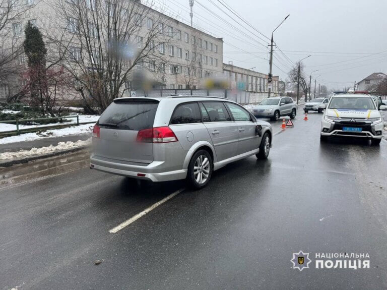 У Житомирі під колеса автомобіля потрапив 7-річний хлопчик: поліція встановлює обставини