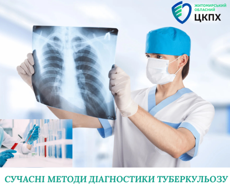 Сучасні методи діагностики туберкульозу