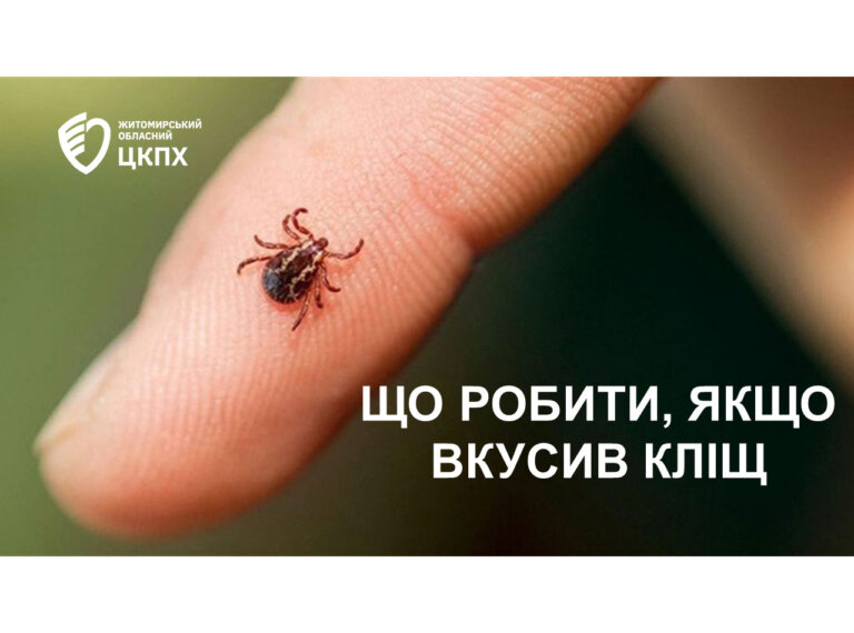 Що робити, якщо вкусив кліщ?
