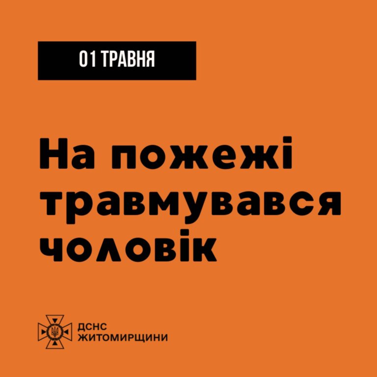 Житомир: на пожежі травмувався чоловік
