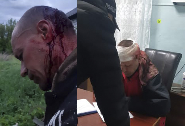 Ситуація: Солдат із с. Недашок стверджує, що його побили співробітники ТЦК, але в ТЦК від цього інциденту відмовляються, аргументуючи, що солдат перебував у СЗЧм