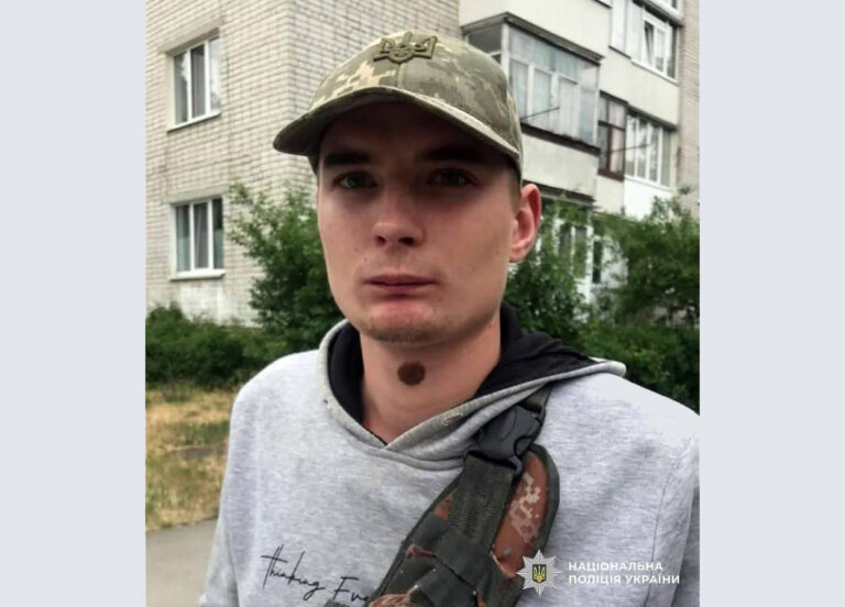 УВАГА! Поліція розшукує безвісно зниклого 20-річного жителя Житомирського району