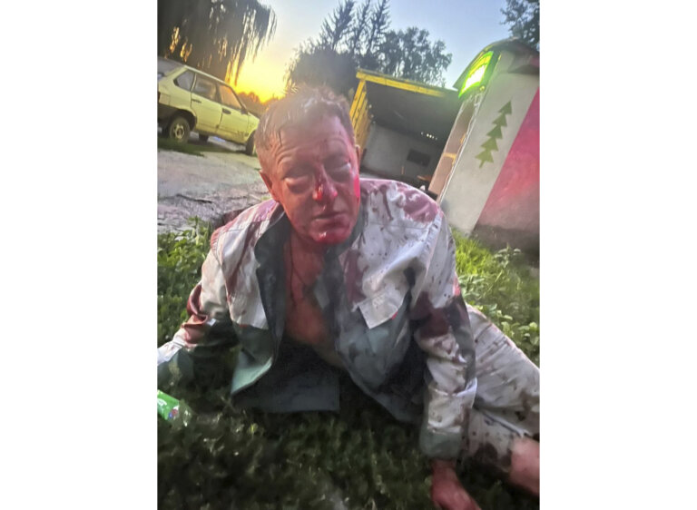 Поліція розслідує завдання тілесних ушкоджень чоловікові на Любарщині