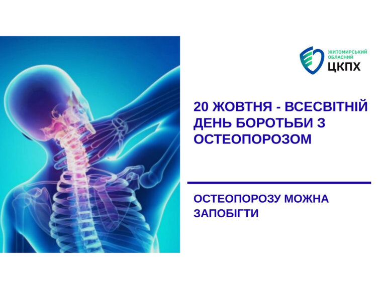 20 жовтня – Всесвітній день боротьби з остеопорозом. Остеопорозу можна запобігти!