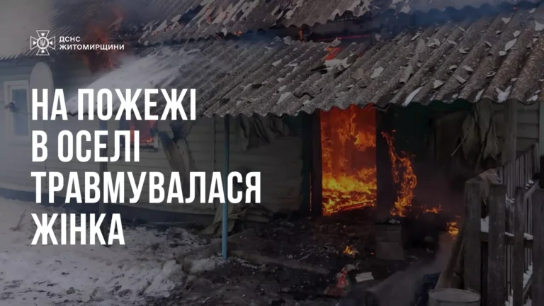 Під час гасіння пожежі у житловому будинку Житомирського району травмувалась людина