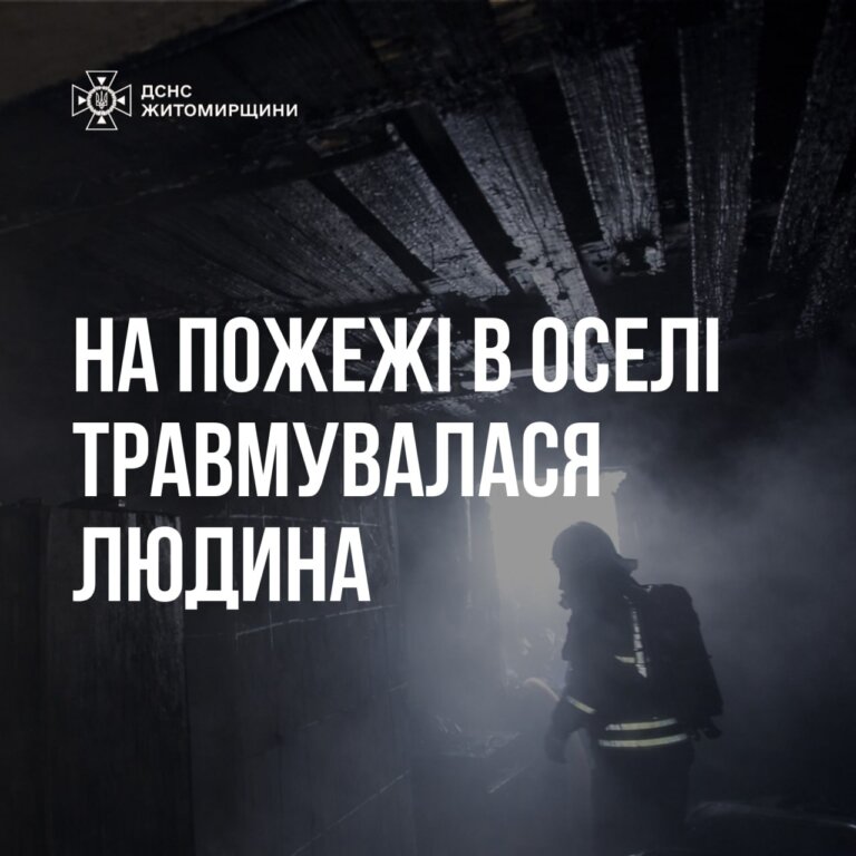 На пожежі в оселі травмувалася людина