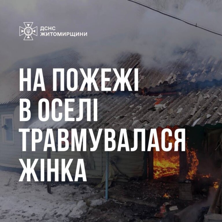 Житомирський район: на пожежі травмувалася жінка