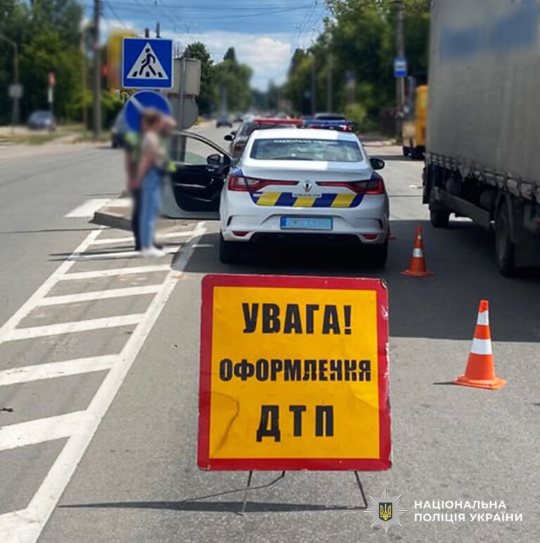 У Житомирі травми в ДТП отримав пішохід: поліцейські встановлюють обставини