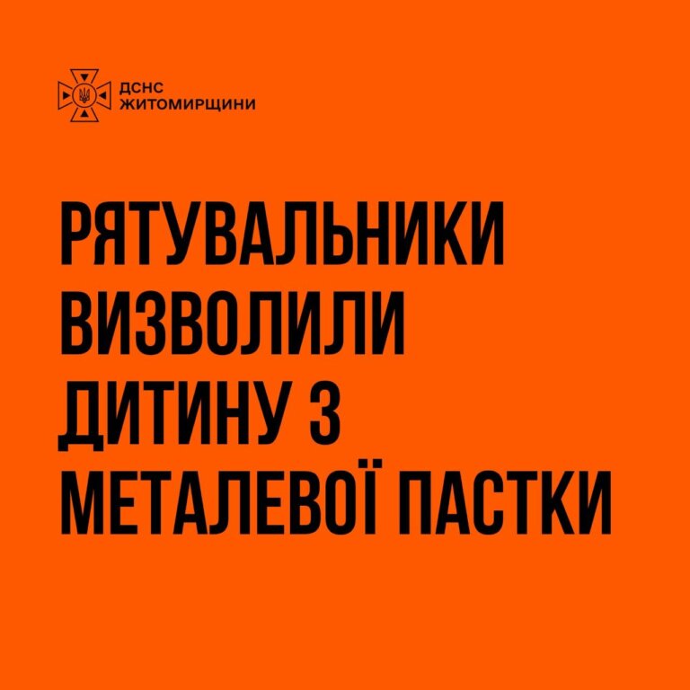 У Радомишлі рятувальники визволили дитину з металевої пастки